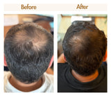 Nourish - Premium Coconut Hair Growth Oil