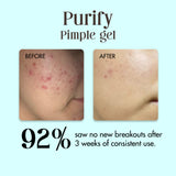 Purify - Pimple Gel