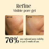 Refine - Open Pores Gel